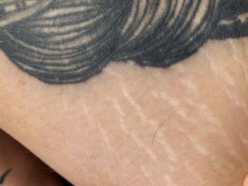 Blowout Wenn dein Tattoo einen Schatten wirft Feelfarbig