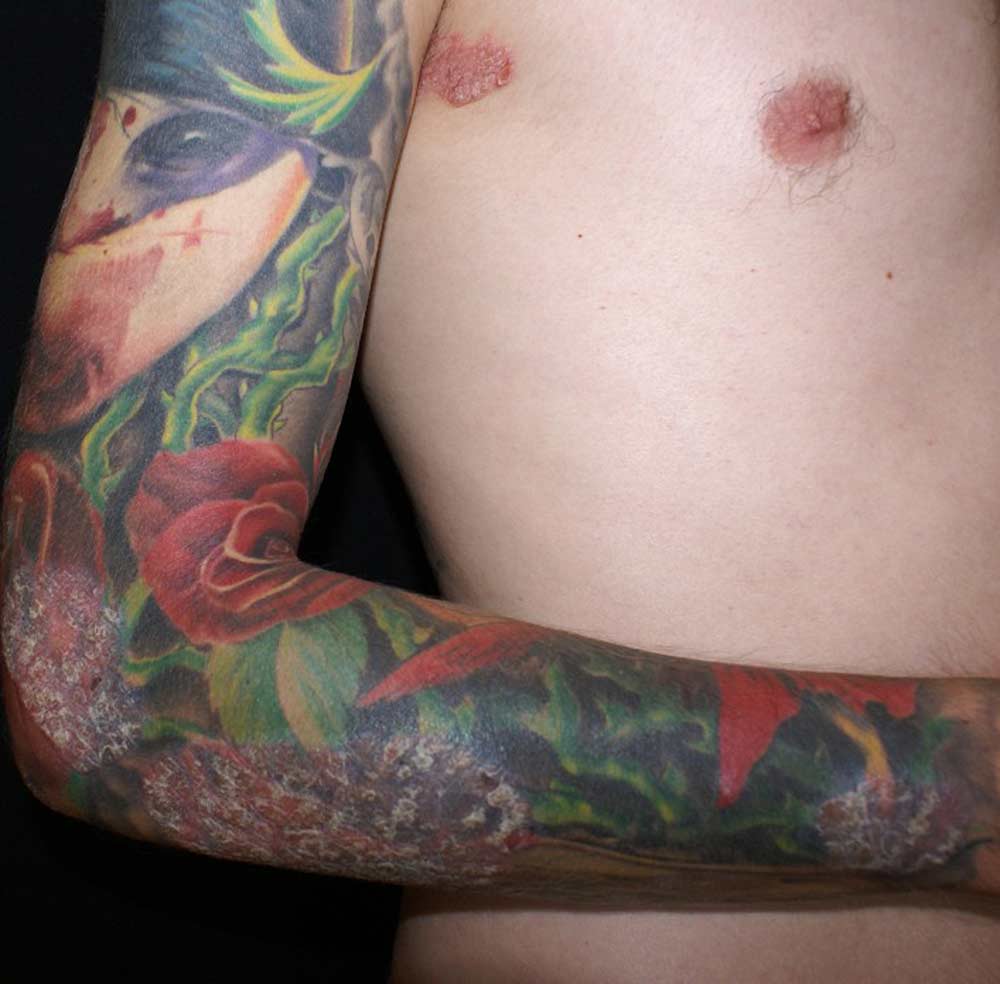 Plaques an einem Tattoo-Sleeve. / © Carol Davila University Press