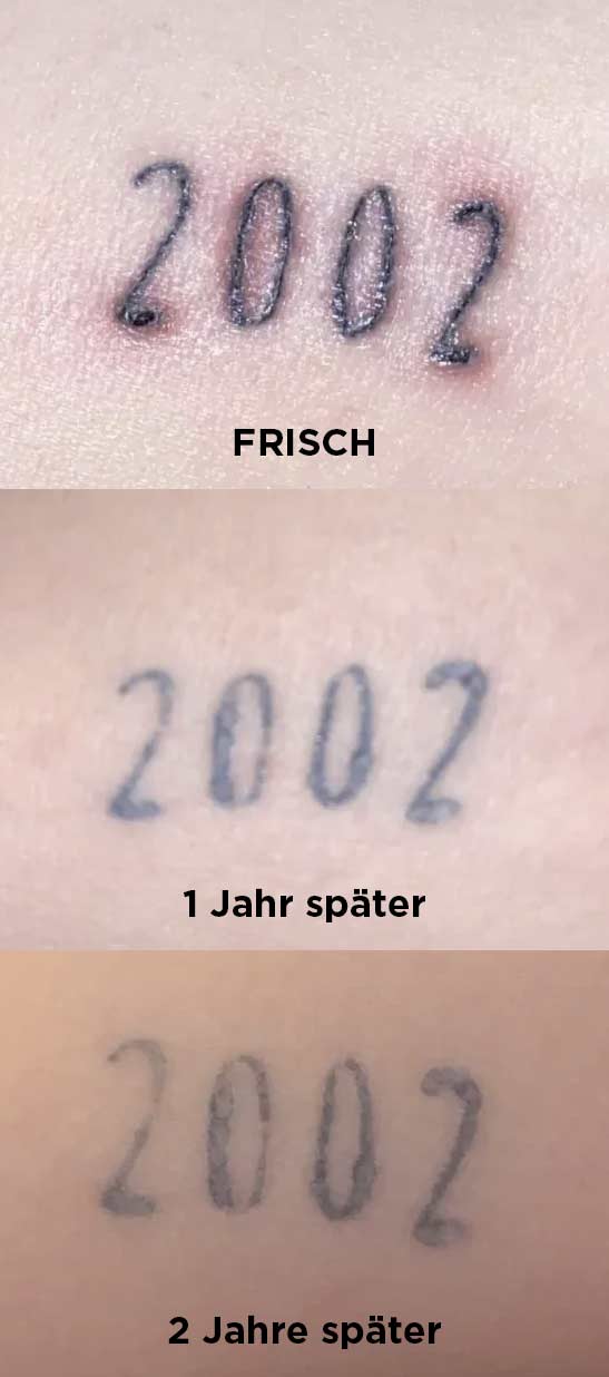 Nach einem Jahr ist dieses Ephemeral Tattoo nur stark verschwommen – aber nicht ausgeblichen. / Fotos: Reddit-User u/ragingtony